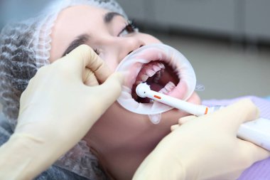 Profesyonel diş temizliği. Elektrikli diş fırçası dişçinin elinde. Dişçi randevusundaki genç bir kız. Dişeti ve sakız hastalıklarının önlenmesi. Ağızda retraktör var..