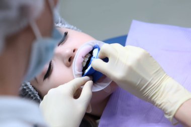 Profesyonel diş ve ağız hijyeni. Doktor profesyonel bir hijyen ürünü uyguluyor. Kariyer önleme. Dişçi randevusundaki genç bir kız. Ağızda retraktör var..