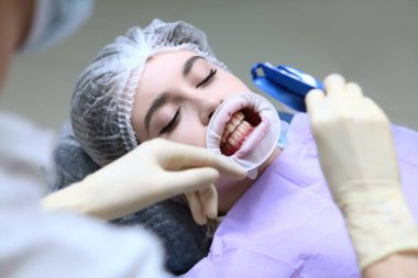 Profesyonel diş temizliği. Diş hekimi profesyonel bir hijyen ürünü uygular. Kariyer önleme. Dişçi randevusundaki genç bir kız..