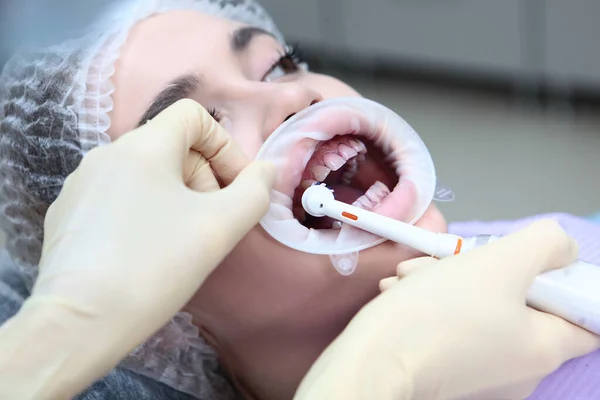 Επαγγελματικός καθαρισμός δοντιών Ηλεκτρική οδοντόβουρτσα στα χέρια ενός οδοντιάτρου. Ένα νεαρό κορίτσι σε ραντεβού με τον οδοντίατρο. Πρόληψη της τερηδόνας και των ασθενειών των ούλων. Συσπειρωτήρας στο στόμα. — Φωτογραφία Αρχείου