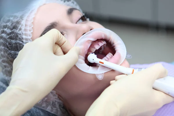 Pulizia professionale dei denti.Spazzolino elettrico nelle mani di un dentista. Una ragazza ad un appuntamento dal dentista. Prevenzione della carie e delle malattie gengivali. Retractor in bocca. — Foto Stock