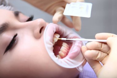 Diş hekimi dişlere koruyucu jel sürer. Profesyonel diş temizliği. Ellerinizi koruyucu eldivenlere koyun. Sağlık kavramı. Taşıyıcıların önlenmesi. Üst görünüm.