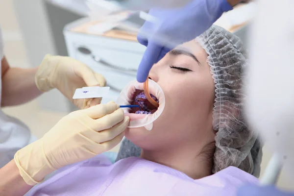 Professional teeth cleaning. The dentist applies a purple gel to the patient's teeth before cleaning. Salivating pump in the mouth. Prevention of caries and gum diseases. Top view.