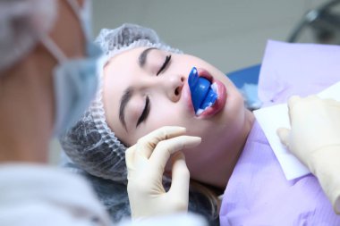 Profesyonel diş temizliği. Doktor kiri temizlemek için profesyonel hijyen ürünü kullanıyor. Taşıyıcıların önlenmesi. Dişçi randevusundaki genç bir kız. Ağızda retraktör var. Üst görünüm.