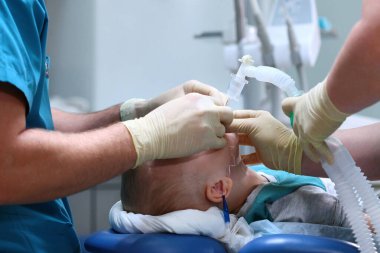 Çocuğa bir solunum tüpü yerleştiriliyor. Ameliyata hazırlanıyorum. Çocuk anestezi altında. Çoklu bakteri tedavisi. Diş sağlığı kliniğinde ameliyat.