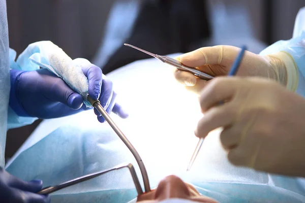 Operasi di klinik gigi. Dokter bedah dan asisten. Foto di ruang operasi. Konsep tentang perawatan kesehatan. Tangan di sarung tangan pelindung. Orang-orang tidak bisa dikenali. Instrumen gigi di tangan. — Stok Foto