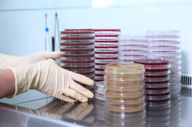 Laboratuvar asistanının ellerinde biyolojik ekinler olan konteynırlar. Tanınmayacak bir insan. Koruyucu eldivenleri verin. Boşluğu kopyala.