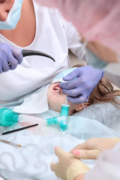 Dítě je v anestezii. Caries léčba primárních zubů v celkové anestezii. Operace v celkové anestezii.Dýchací trubice během operace. Svislá fotografie. — Stock fotografie