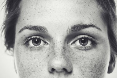 Kadın yüzü çilli