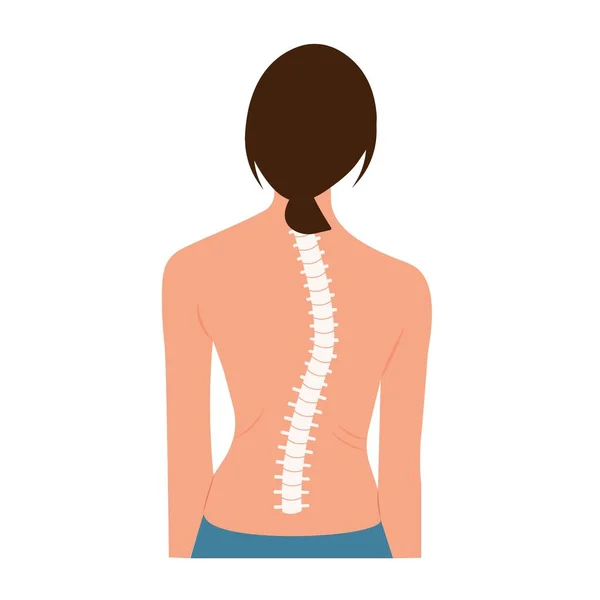 Skolyoz omurga eğrisi anatomisi, duruş düzeltmesi. Kayropraktik tedavi. Omurga eğriliğini ve omurga eğriliğini temsil eden kadının vektör çizimi