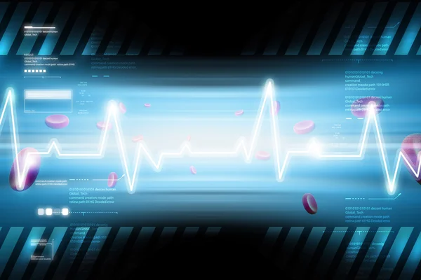 Monitor cardíaco com cardiograma — Fotografia de Stock