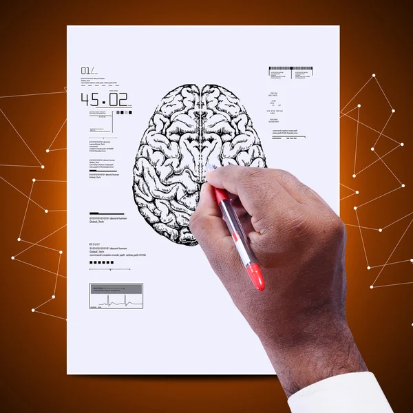 Doctor with human brain diagram — Stock Photo, Image