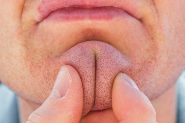 Face of a man with ass-like chin funny faces.