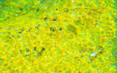 Güneydoğu Asya 'da Patong Sahili' ndeki kayaların arasında yüzen balıklar Güney Tayland 'da Kathu Bölgesi Phuket Adası' nda.