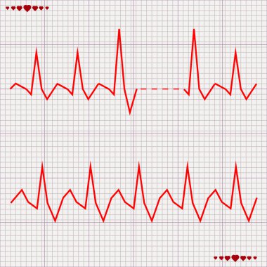Vektör - kalp kardiyogram yendi.