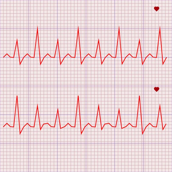 Vector - Heart beats cardiogram — Stock Vector