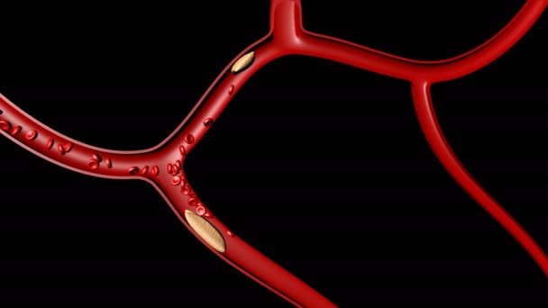 Thrombus de caillot 3d pour la santé médicale sur noir — Video