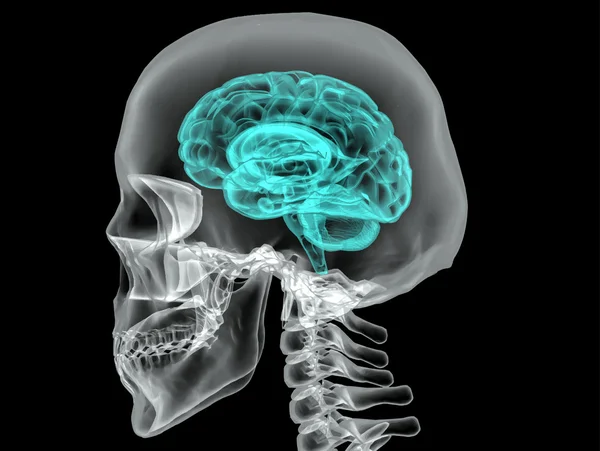 Concepto de un cerebro humano activo en un vector oscuro — Archivo Imágenes Vectoriales