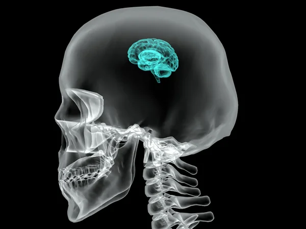 Έννοια του ένα ενεργό ανθρώπινου εγκεφάλου σε ένα σκοτεινό διάνυσμα — Διανυσματικό Αρχείο
