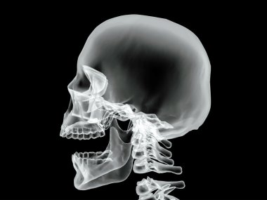 Vektör kırık kemik x-ray görüntüsü