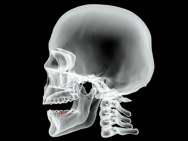 Blauwdruk met x-ray — Stockvector