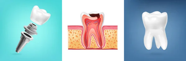 Conceito de Design de Anatomia dos Dentes — Vetor de Stock