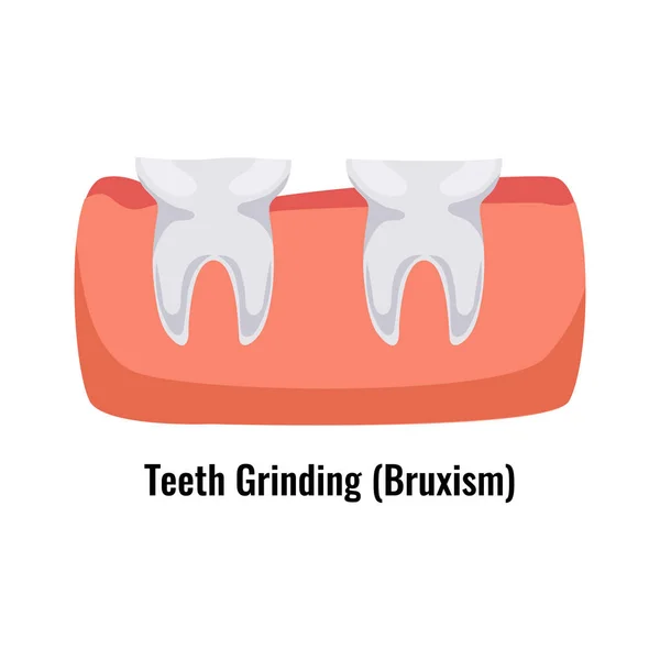 Affiche sur les problèmes dentaires — Image vectorielle