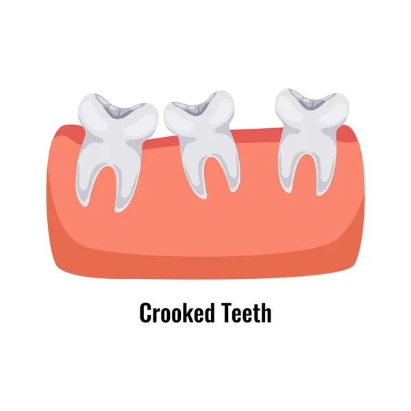 Cartaz do problema dentário — Vetor de Stock