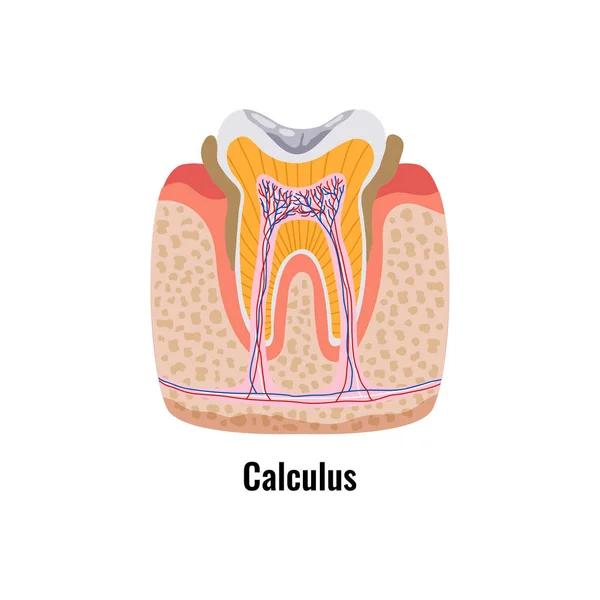 Poster mit Zahnproblemen — Stockvektor