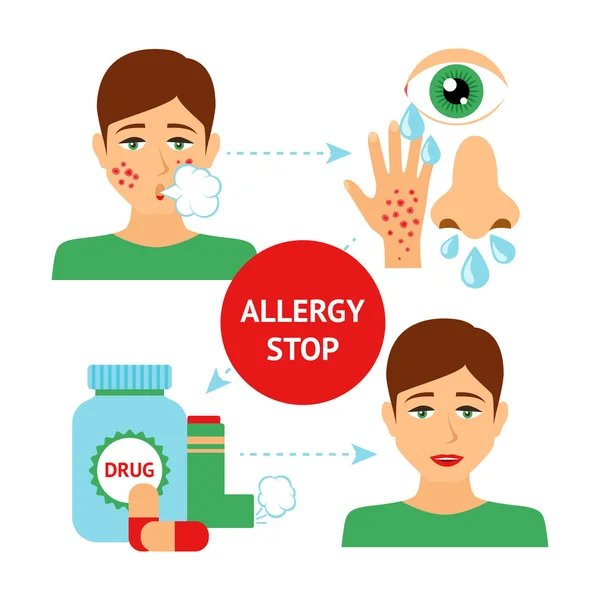 Concepto de prevención de la alergia — Vector de stock