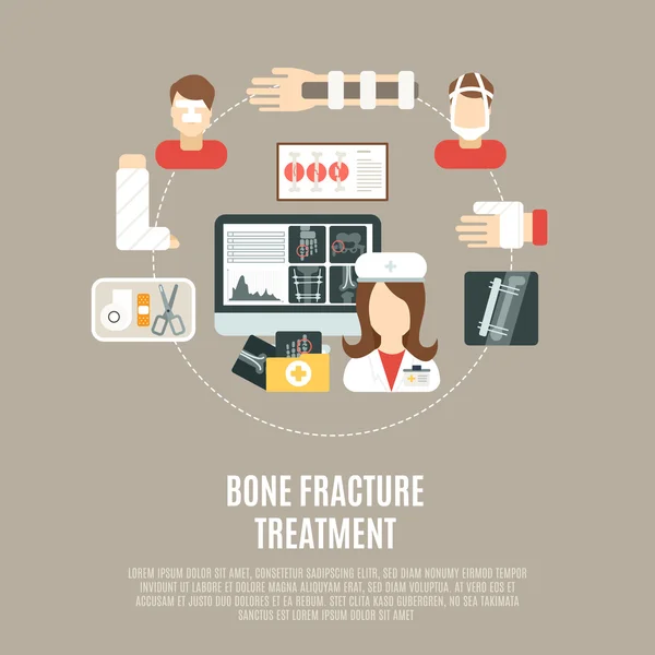 Fractura Tratamiento óseo — Vector de stock