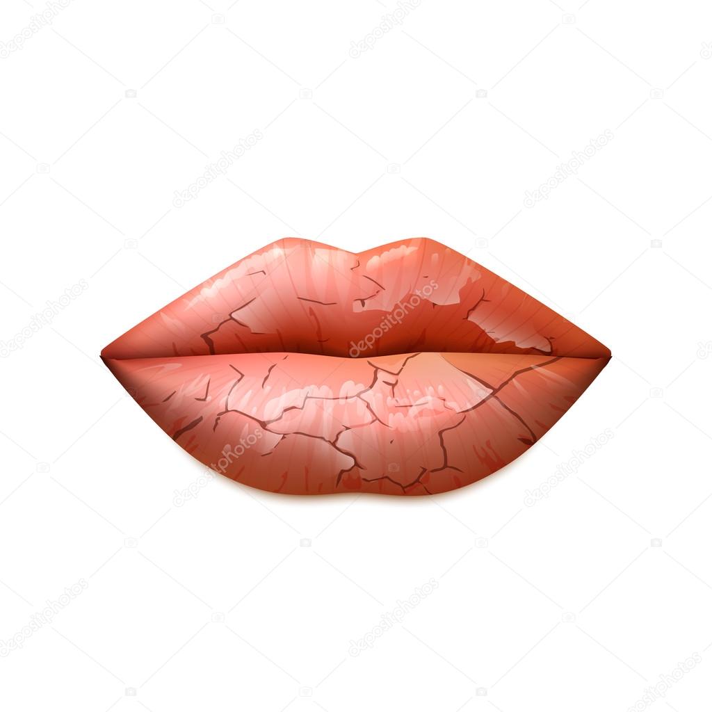 Dry Lips Illustration