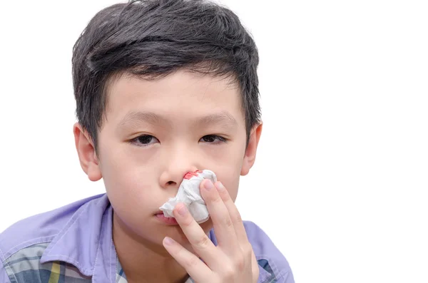 男孩从他的鼻子，用纸巾擦血 — 图库照片