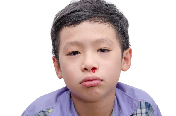 Niño con sangrado de la nariz sobre blanco — Foto de Stock