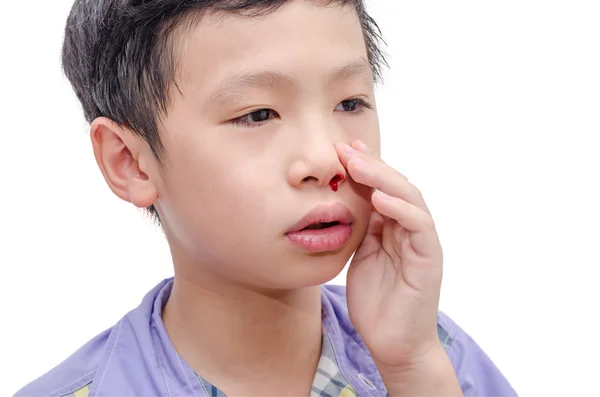 Niño con hemorragia nasal — Foto de Stock