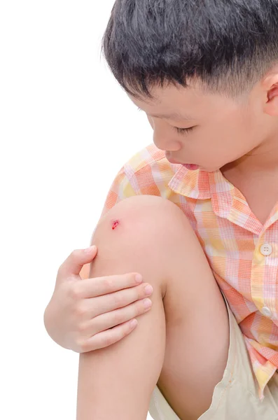 Boy with wound on the knee — Stock Photo, Image