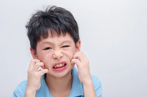 Boy škrábání jeho tvář alergie — Stock fotografie