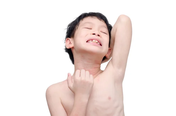 Boy scratching his skin over white — Stock Photo, Image