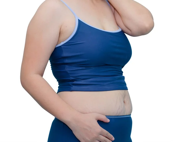 Fat Asian woman in swim suit on white background — Stock Photo, Image