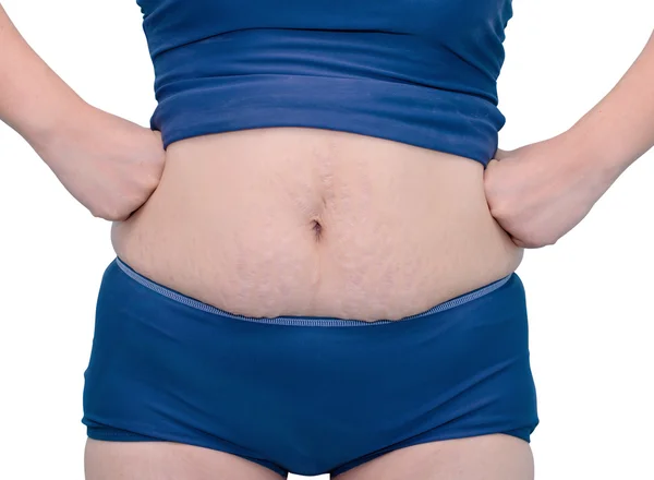 onu germek işaretleri gösterilen Yüzme elbiseli kadın