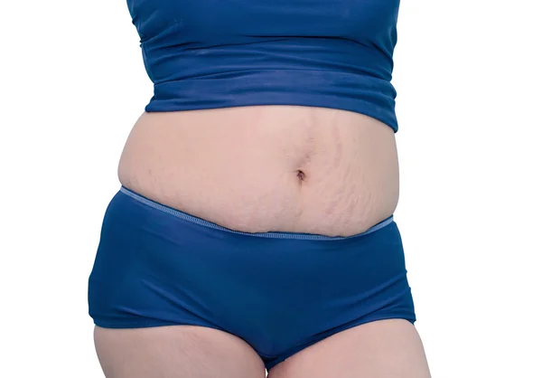 onu germek işaretleri gösterilen Yüzme elbiseli kadın