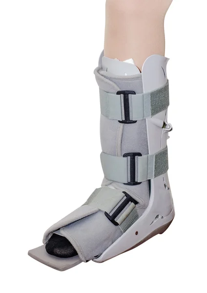 Perna com uma cinta de tornozelo — Fotografia de Stock
