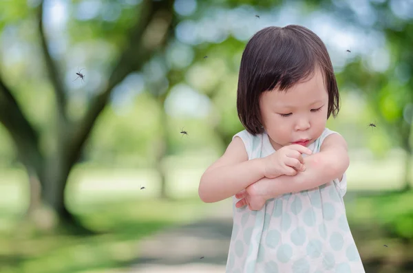 Lilla flickan har allergier med mygg bett — Stockfoto