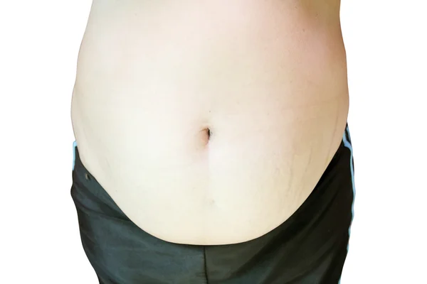Stretch marque sur l'estomac femme mature — Photo