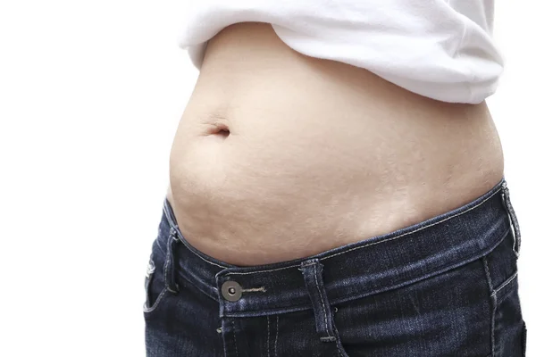 Asyalı kadın göbek üzerinde streç işaretleri