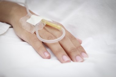 Hastanın hastanede serum fizyolojik Intravenous (IV)