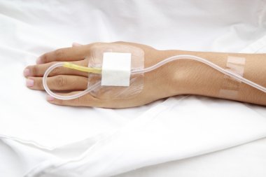 serum fizyolojik Intravenous (IV)