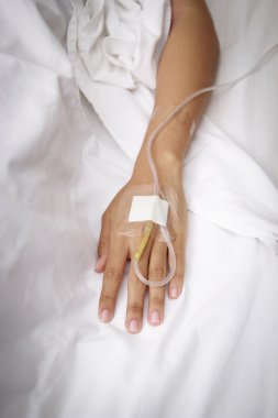 serum fizyolojik Intravenous (IV)