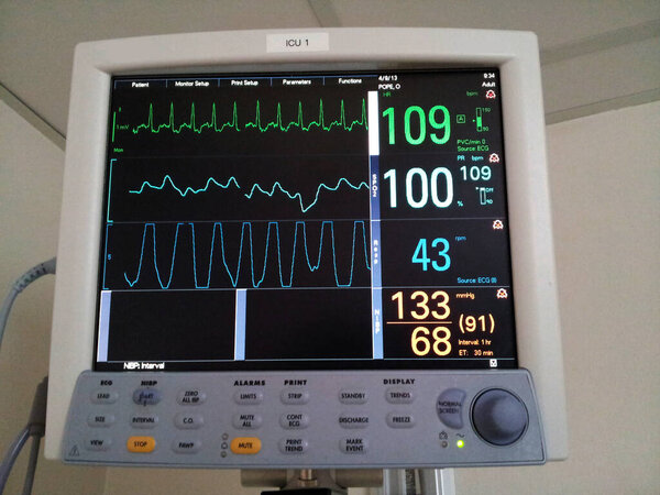 Экран ЭКГ, пульса, давления и дыхания