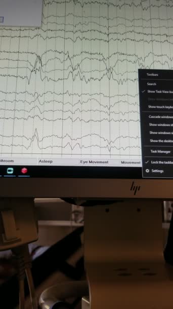 EEG Εμφάνιση ιχνών εγκεφαλικών κυμάτων από πολλαπλά καλώδια — Αρχείο Βίντεο